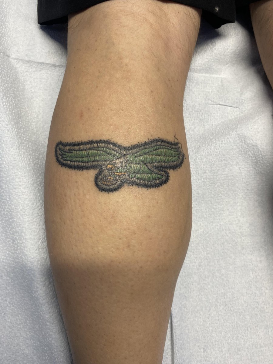Photo of the tattoo titled Healed vs Fresh Patch Tattoo