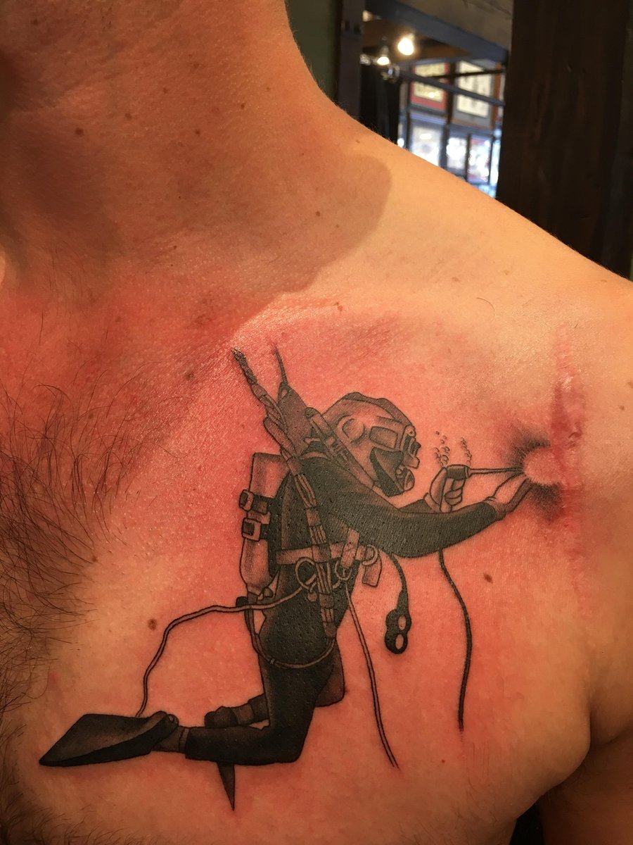 Photo of the tattoo titled Transforming Scar into Art