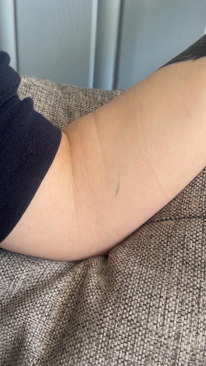 Photo of the tattoo titled Accidental Ink: A Happy Little Accident