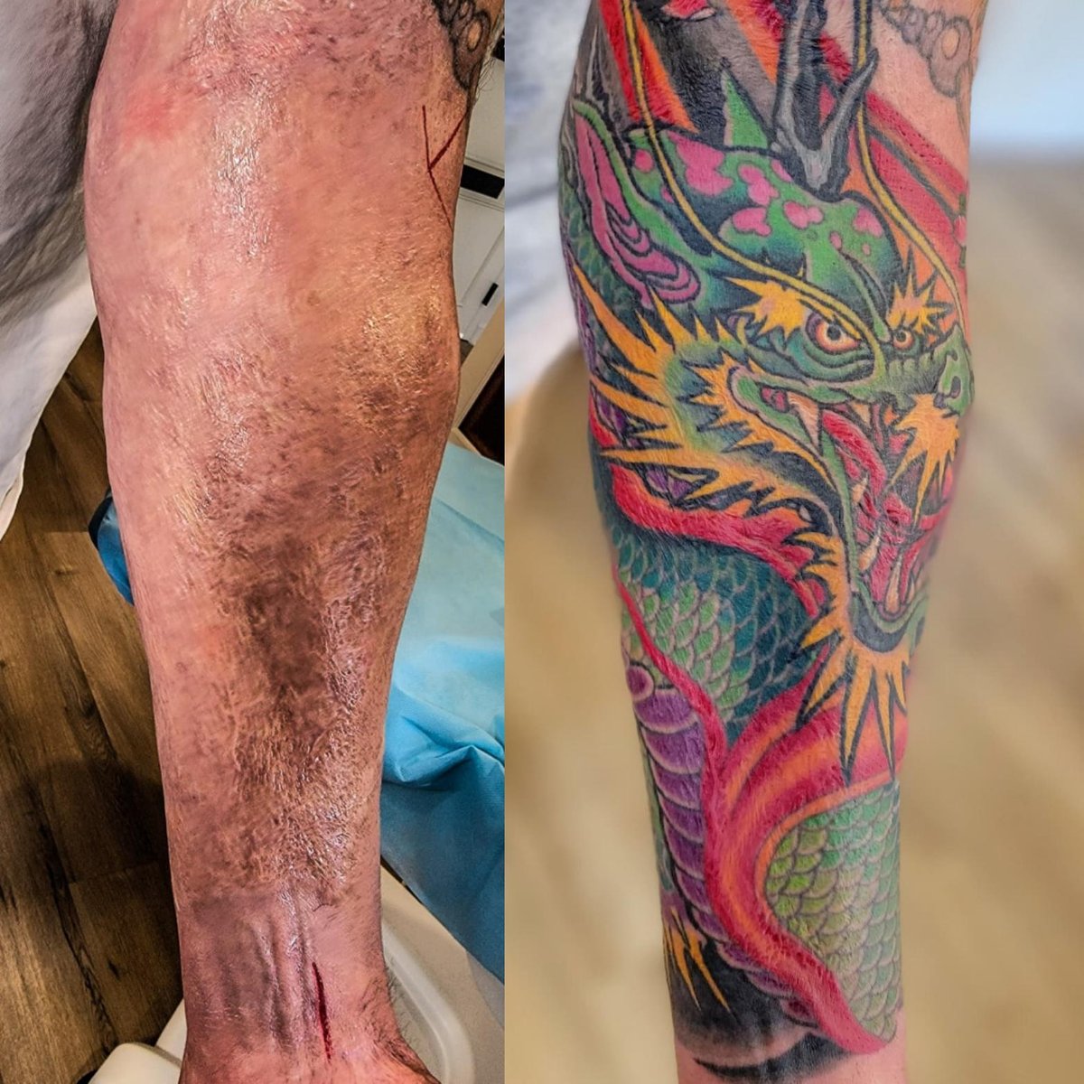 Photo of the tattoo titled Fire Dragon Over Burn Scars