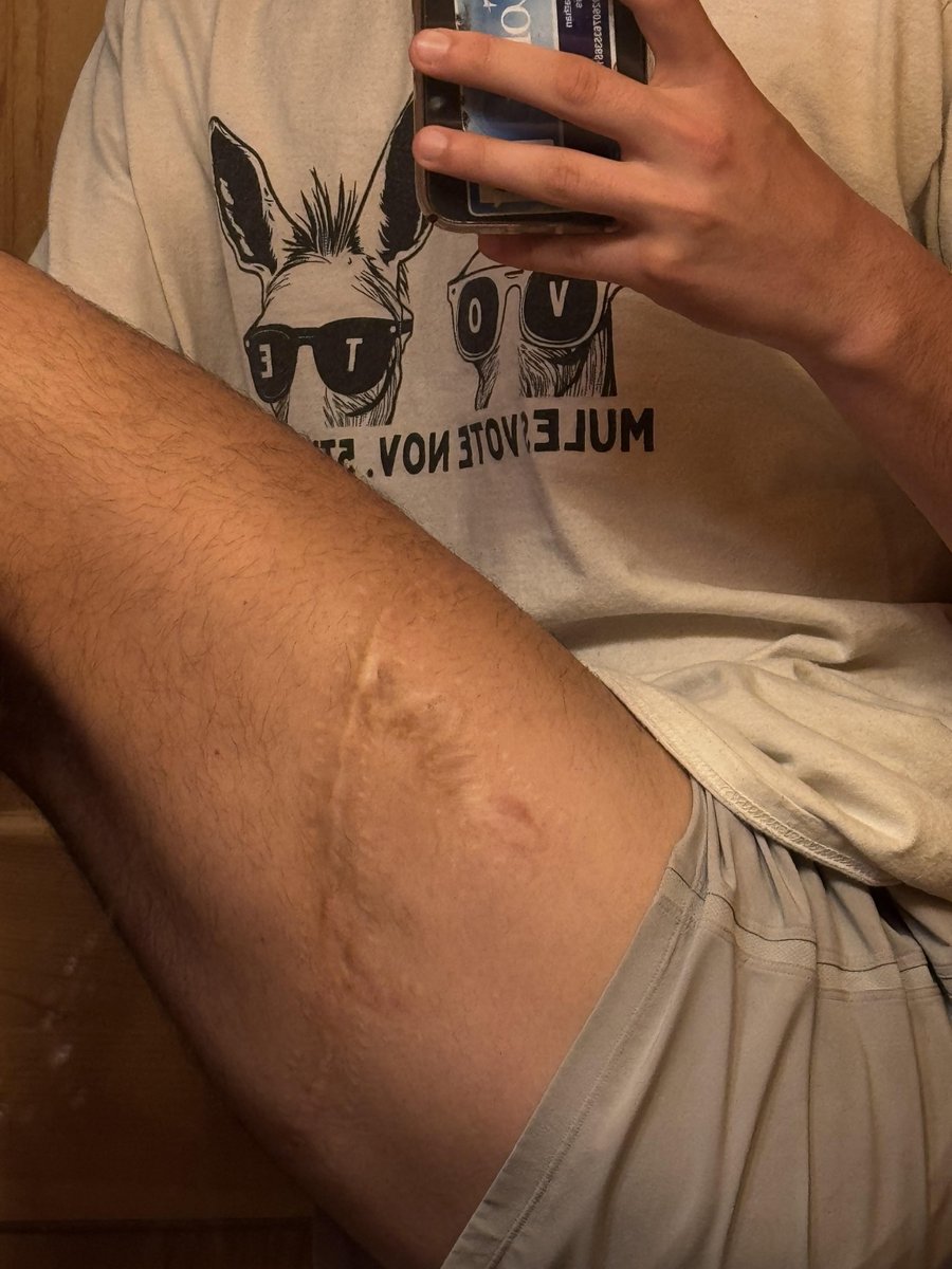 Photo of the tattoo titled Transforming My Scar Into Art