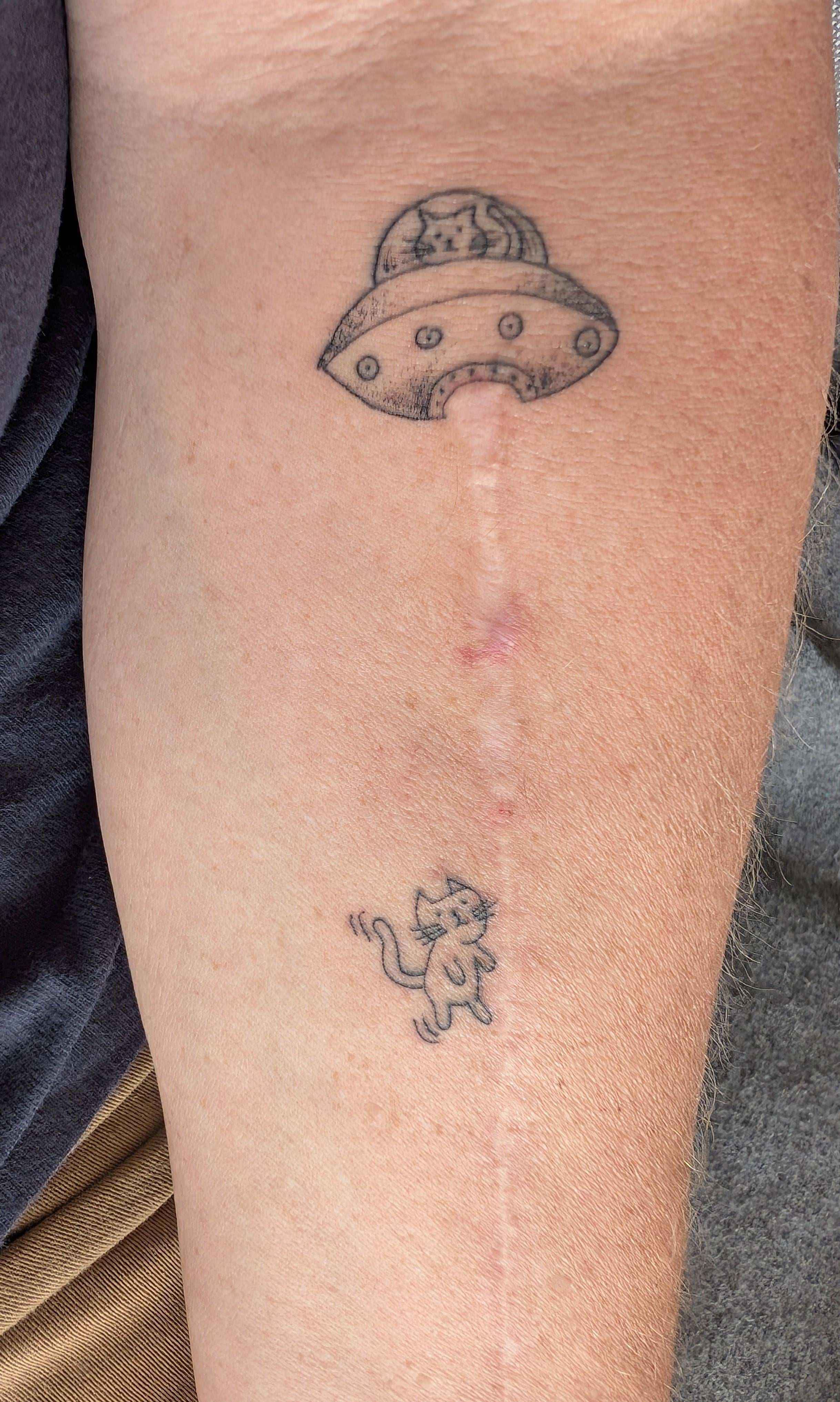 Photo of the tattoo titled UFO Tattoo Embraces Arm Scar