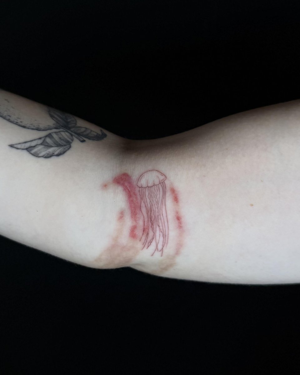 Photo of the tattoo titled Jellyfish sting healing art