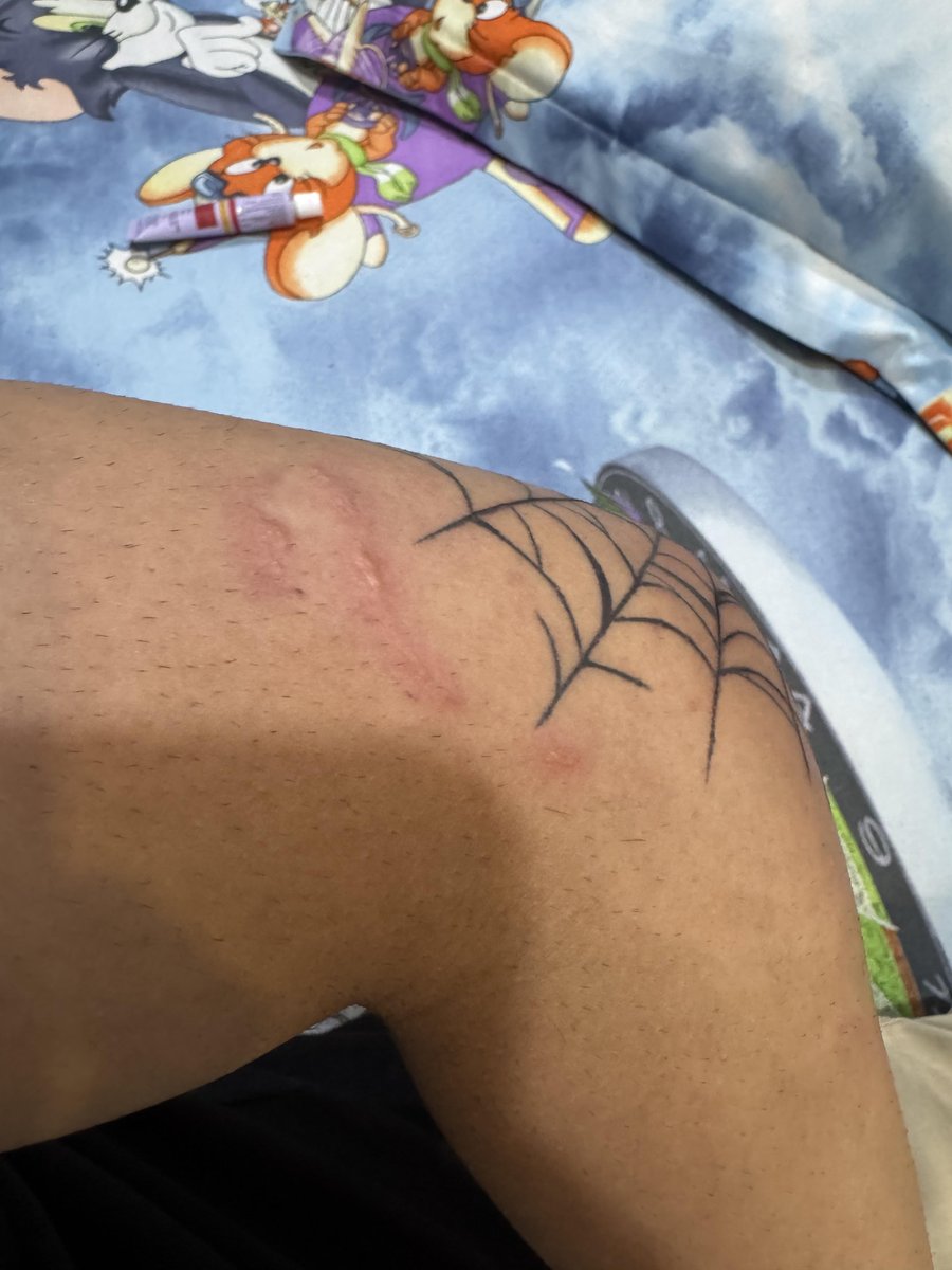 Photo of the tattoo titled Post-Touch-Up Bumps Concern
