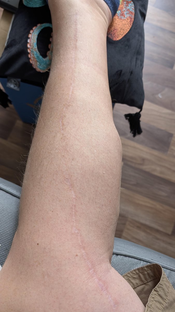 Photo of the tattoo titled Transforming Scars into Art